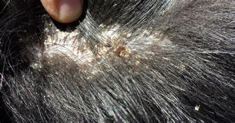 RYDER Kennel: TREATING DANDRUFF IN DOGS By Ryder Kennel