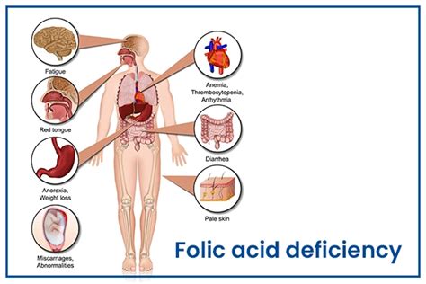 Folic Acid Deficiency - Causes, Symptoms & Treatment