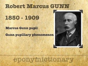 Marcus Gunn Pupil • LITFL Medical Blog • Medical Eponym Library