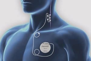 Benefits of vagus nerve stimulation – Happy Body Formula