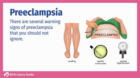 What to Know about Preeclampsia | Birth Injury Guide