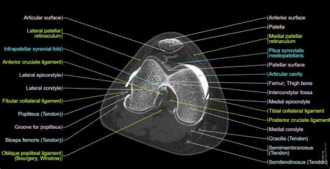 Anatomy of the knee (CT arthrography) | e-Anatomy