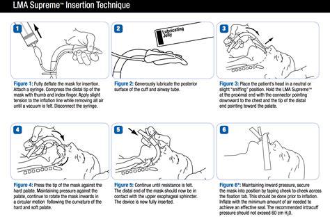 Laryngeal Mask Airway Insertion