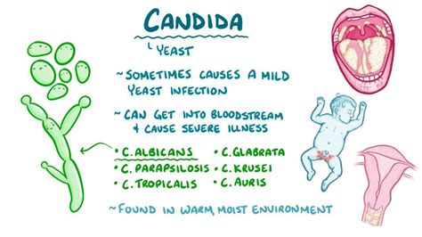 Candida Auris Infection: What Is It, Causes, Signs, and More | Osmosis