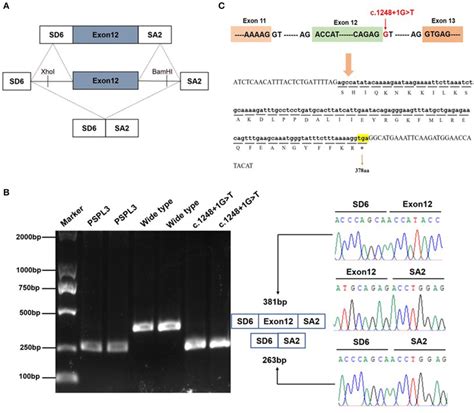 Effect of the KMT2E gene c.1248+1G>T variant determined by minigene ...