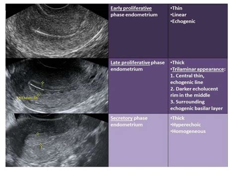 What is uterus Layers of Uterus and 2.pptx