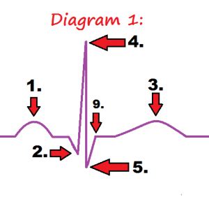 EKG PQRST Rhythm Strip Wave Quiz | Anatomy & Pathophysiology