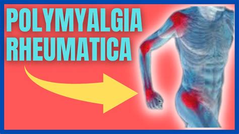 What is Polymyalgia rheumatica? Symptoms, Causes & Treatments - YouTube