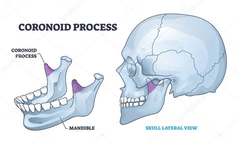 Coronoid process anatomy with isolated bone and skull view outline diagram. Labeled educational ...