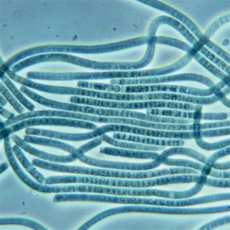 Oscillatoria Under A Microscope