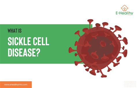 Sickle Cell Disease: Symptoms, Treatments, And Insights