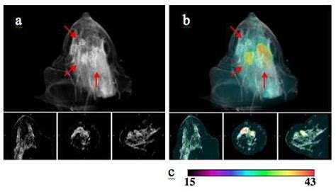 Image-guided NIR Spectroscopy | Optics in Medicine