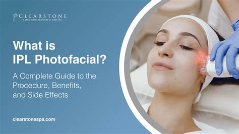 What is IPL Photofacial? A Complete Guide to the Procedure, Benefits, and Side Effects