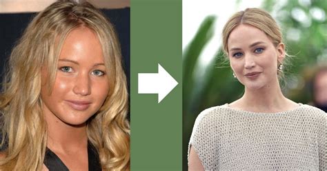 Jennifer Lawrence Plastic Surgery: Revealing The Truth Behind The Rumors!