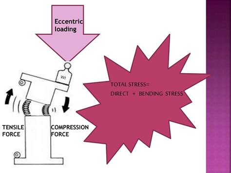 Principle of tension band wiring n its application