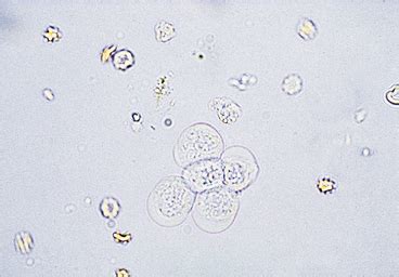 many epithelial cells in urine