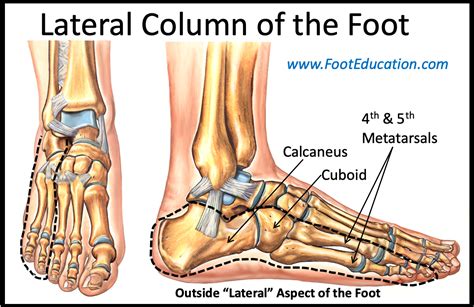 Lateral Column Lengthening - FootEducation