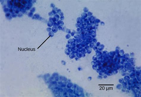 Characteristics of Fungi | Boundless Biology