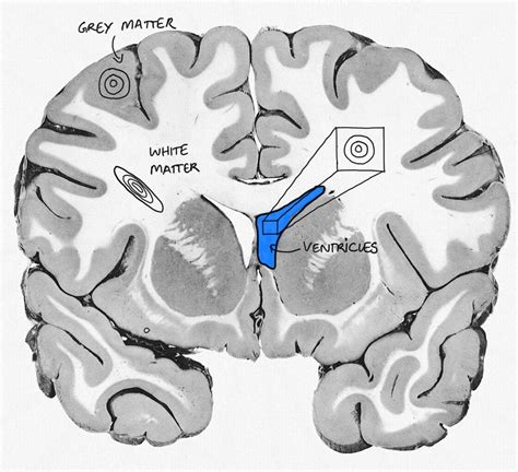 Computational models for Diffusion MRI – Machine Learning and Me