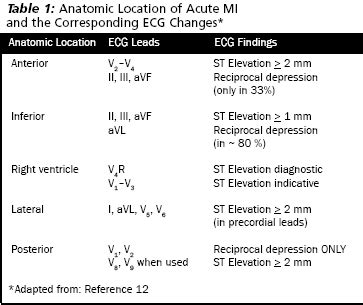 Myocardial Infarction Ecg Interpretation