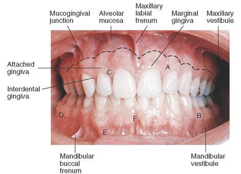 Clinical appearance of gingiva. A, Attached gingiva above and interdental papilla below; B ...