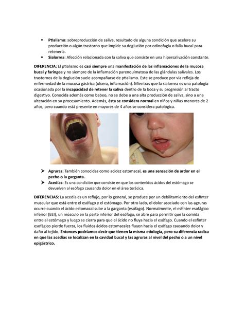 Ptialismo y sialorrea, agruras y acedias diferencias - Ptialismo: sobreproducción de saliva ...