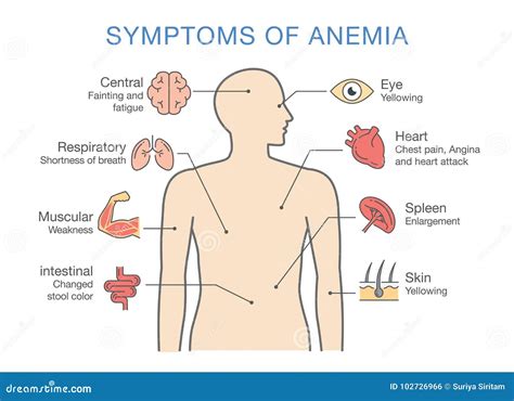 Symptoms Of Anemia. Round Banner. Iron Deficiency Royalty-Free Stock ...