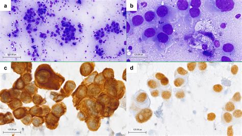 An economic evaluation of fine-needle cytology as the primary diagnostic tool in the diagnosis ...