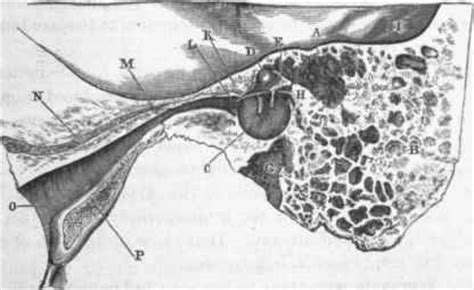 II. Affections Of The Middle Ear