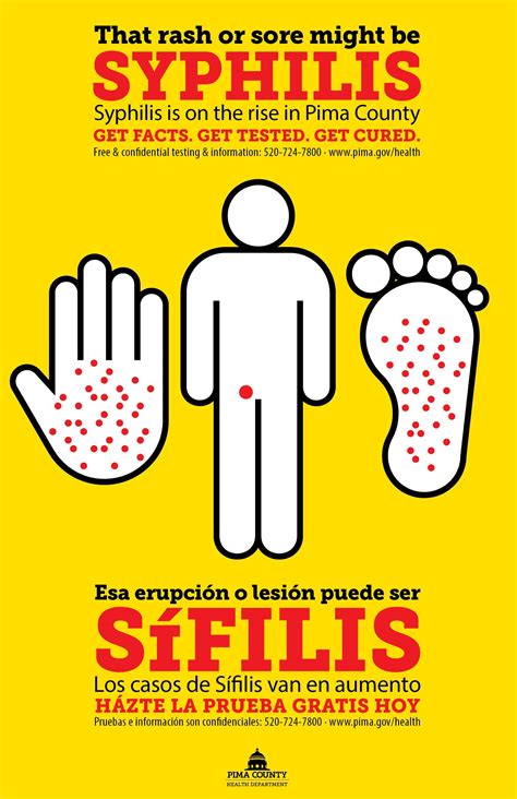 Syphilis is on the rise – BHOC