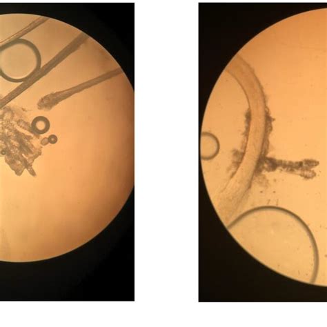 Demodex folliculorum (a) and D. brevis (b) under a light microscope,... | Download Scientific ...