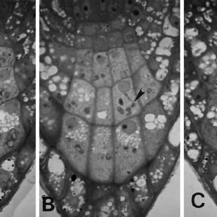 Central columella cell (inside-“right”) after reorientation of the... | Download Scientific Diagram