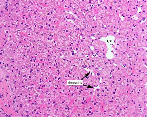 Normal Liver Histology 101 | AASLD