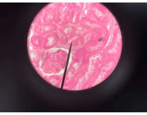 Histology - Nephron 600x Quiz