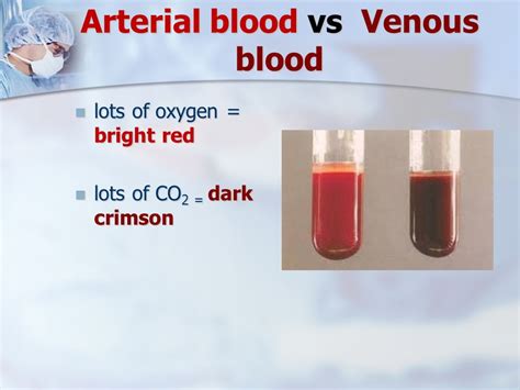 Human blood color: deoxygenated blood vs oxygenated blood | different ...