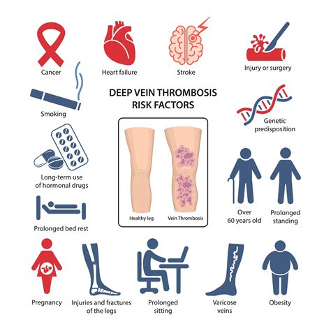 Deep vein thrombosis. El Paso I&I Specialists Vascular experts. 915-260-6902