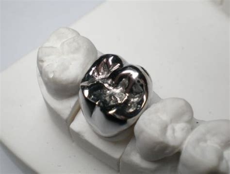 White Gold Crown Tooth