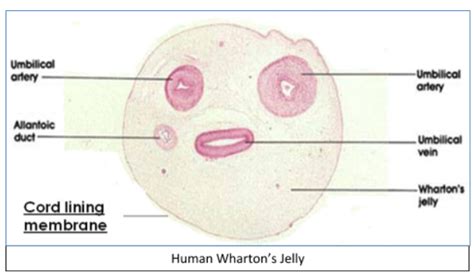 The Wharton’s jelly in umbilical cord is:A. Mucoid connective tissueB ...