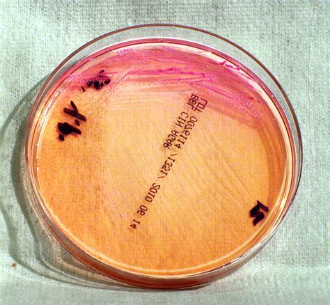 Free picture: gram, negative, yersinia pestis, bacteria, grown, cefsulodin, irgasan, novobiocin ...