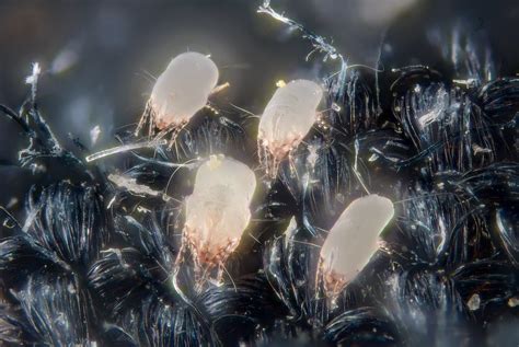 House dust mites | House dust mites (Dermatophagoides pteron… | Flickr