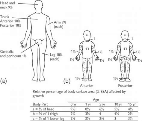 Lund and Browder Chart | ... ‘rule of nines’. (b) The Lund and Browder ...