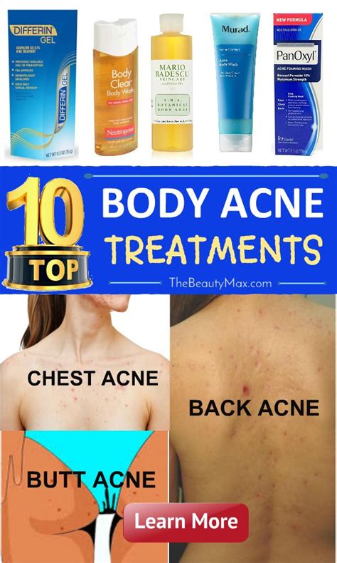 Pin by Acne Go Away on Body acne treatment | Body acne treatment, Body ...