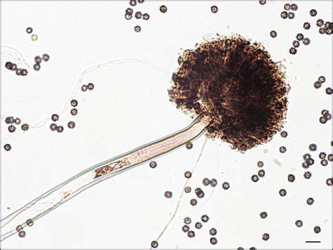 Aspergillus niger