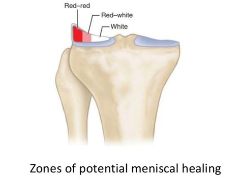 Meniscus - Anatomy, function and injury