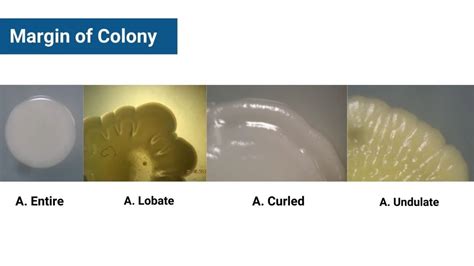 Colony Morphology of Bacteria and Examples - Biology Notes Online