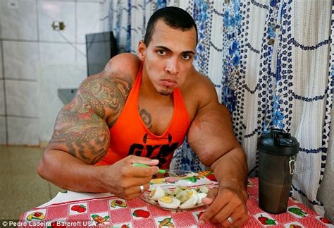 Meet the incredible hulk from Brazil, who injected oil into his biceps ...