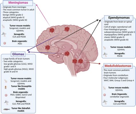 Frontiers | Modeling Brain Tumors: A Perspective Overview of in vivo ...