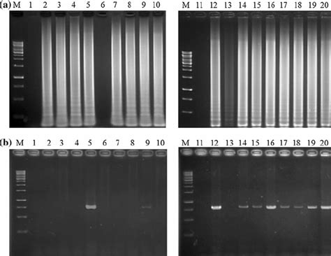 Clinical samples tested by LAMP and PCR. Twenty clinical bursa samples ...