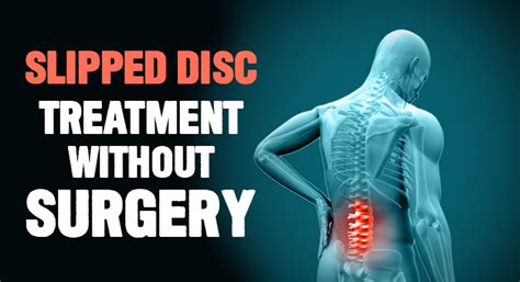 Slipped Disc Treatment Without Surgery in Ayurveda - SureShot Ayurveda