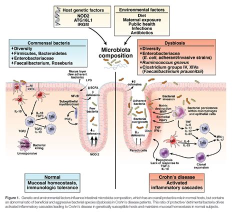 Crohn's disesase microbiota Public Health, Gut Health, Gut Microbiota, Ulcerative Colitis ...